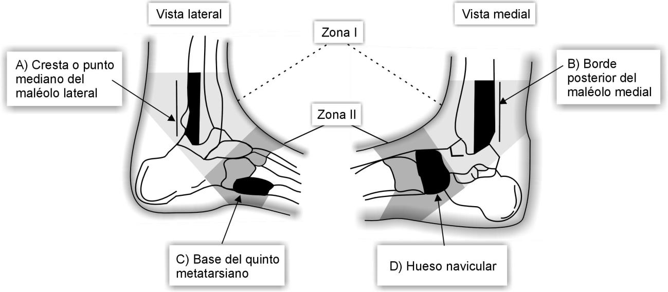 Vista De Tratamiento Conservador Del Esguince De Tobillo Recimundo