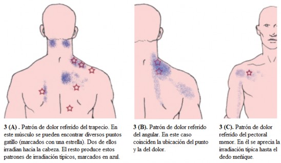 La prevención, objetivo para evitar las contracturas y molestias cervicales  por el frío